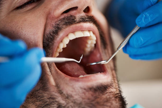 Best Weekend Emergency Dental Services in Morse, LA